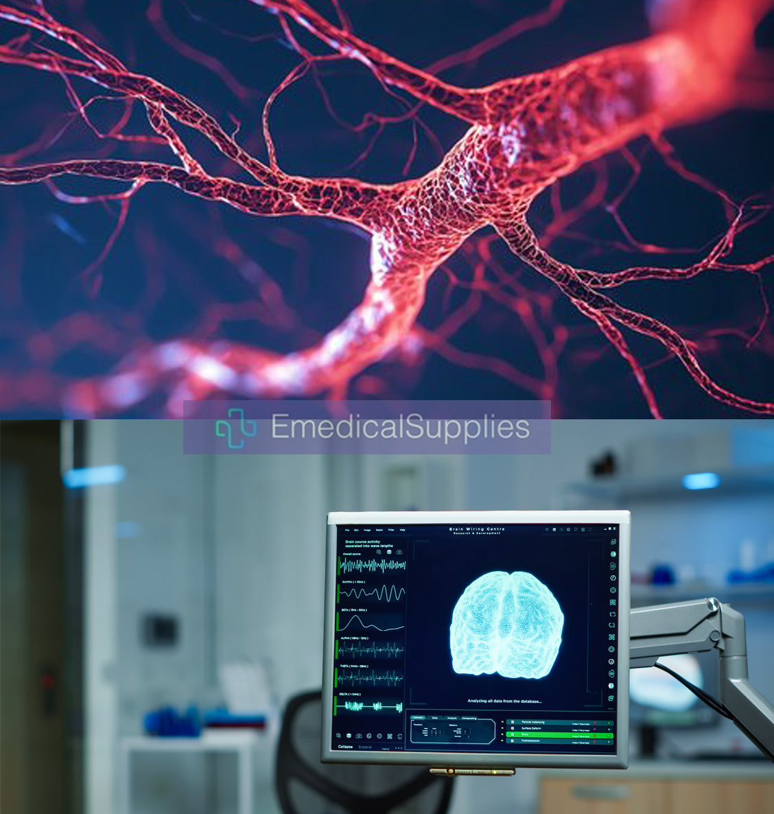 Neuroradiology & Vascular